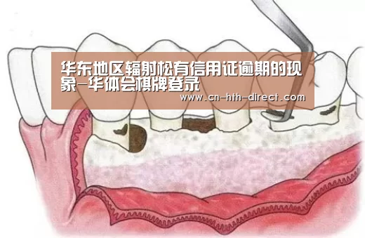 华东地区辐射松有信用证逾期的现象-华体会棋牌登录(图2) 华体会登陆